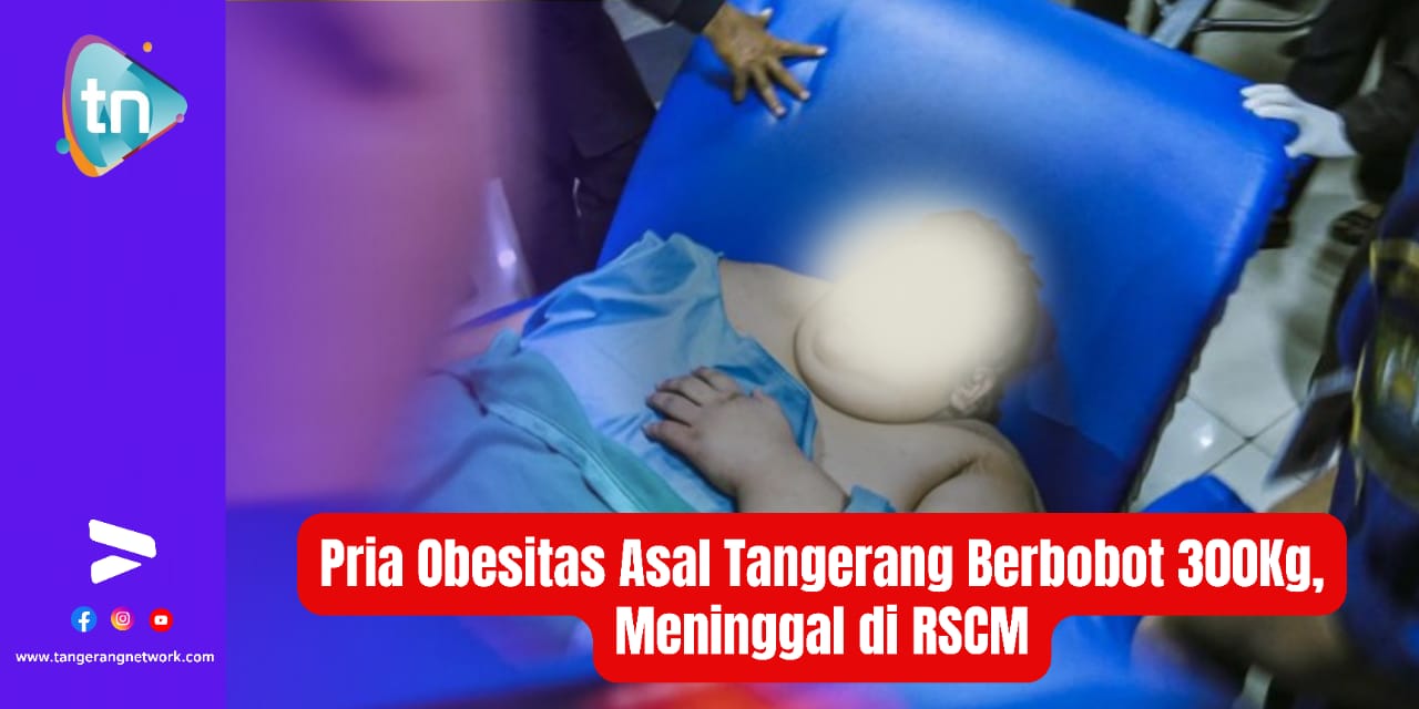 Pria Obesitas Asal Tangerang Berbobot 300 Kg, Meninggal di RSCM