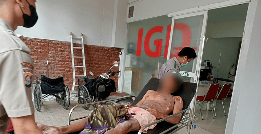 Warga di Kab.Tangerang Alami Luka Bakar Serius Akibat Tersengat Listrik